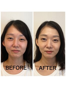 アマルジーナ(AmalZwina)/【パーソナルカラー診断】