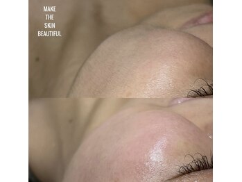 シエル(ciel)/フェイスwaxでスッピンから艶を