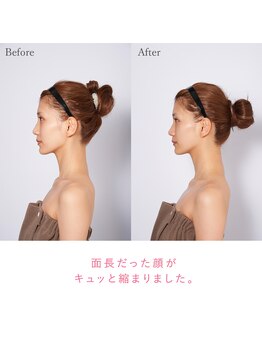 リュクス(Luxe+TKM HANATEN)/華奢みえ 小顔コルギ