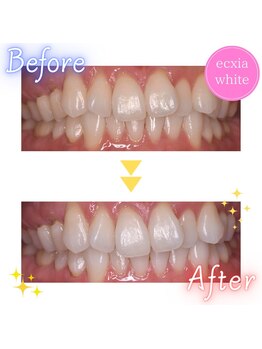 エクシアホワイト SOKA(ecxia white)/