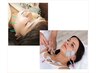 新規・むくみを取って小顔・リフトアップ【美容鍼+微弱電流】60分¥6980