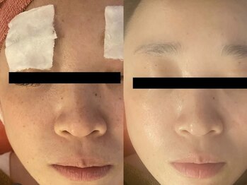 スターリィ スカイ(Starry☆Sky)/美白トリートメント