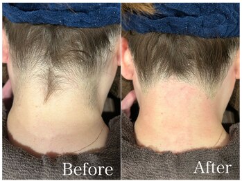 ジョエルワックス 沖縄那覇店(JOELLE WAX)/綺麗なうなじつくりませんか？★