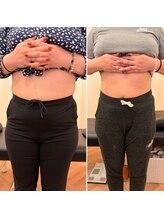 ナオ接骨院(NAO接骨院)/Before／After