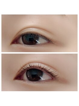 ラフィーネ(Raffine)/アッパーリフトカール