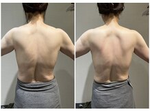 ロッタ エクリュ(Lotta ecru+)/筋膜リリースマッサージ