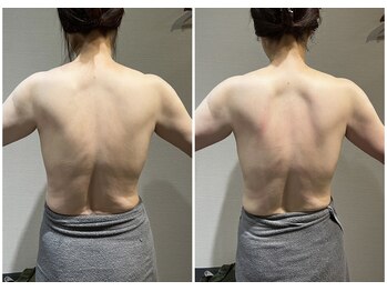 ロッタ エクリュ(Lotta ecru+)/筋膜リリースマッサージ