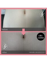 ビューティーボディ 名寄(The Beauty Body)/