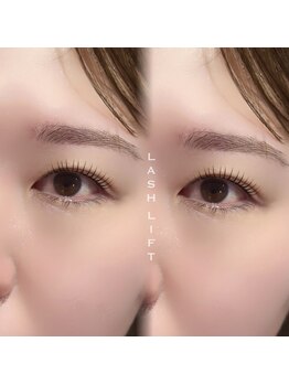 ミニョン(Mignon)/ラッシュリフト/まつげパーマ