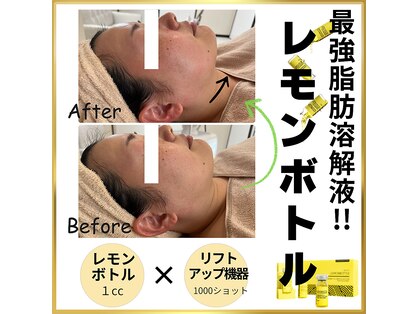 ラウレア(Laule'A)の写真