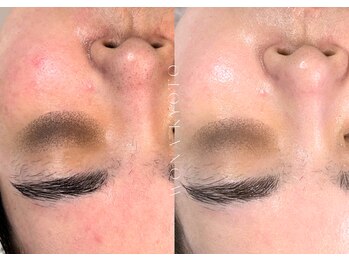 ウォナ(WONA)/【お客様症例】