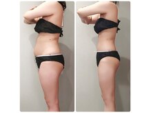 何をやっても痩せられなかった方！サイズダウンならおまかせ★