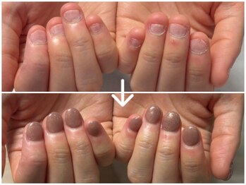 アトリエレポの写真/自力では繰り返す深爪も、2時間の集中ケアで見違える指先へ◎爪の悩みに寄り添い、理想の形を叶えます♪