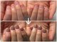 アトリエレポの写真/自力では繰り返す深爪も、2時間の集中ケアで見違える指先へ◎爪の悩みに寄り添い、理想の形を叶えます♪