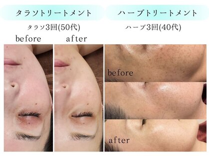 ラッシュビューティー(LASH Beauty)の写真