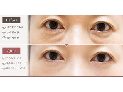 トウゲンキョウの写真