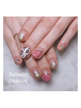 トレジャー(treasure)/