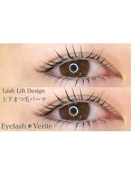 リンド エステ まつげ 京成大久保(Lind)/上下まつ毛パーマ