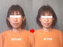 アトラス/初回のお客様のBefore＆after