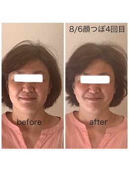 グラナダ 2F(Granada)/