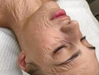 テジナ(tejina)の写真/【海外セレブ御用達★】SNSで話題のゾンビマスク導入店◎シワや毛穴を引き締めてお肌のハリ感をUP！