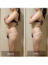 ココカラ(COCOKARA)/インディバ&アロマ痩身