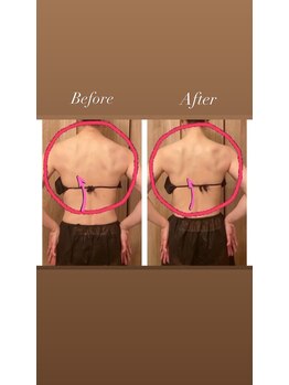 チェリッシュ(cherish)/肩甲骨剥がしで背中美人に