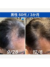 リフェロ 豊橋店(Refero)/Refero3本使用変化