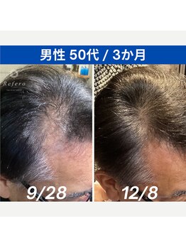 リフェロ 豊橋店(Refero)/Refero3本使用変化