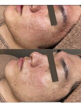 ミレマユメイク(mire)/くすみ改善/明るい素肌づくり