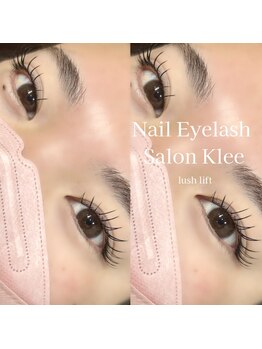 クレー(Klee)/フラットラッシュ