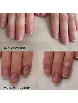 ニマ(nima)の写真/【大人の女性も通いやすいネイルケアが得意な自爪育成サロン】モットーは爪を痛めず最短で希望の爪に導く事