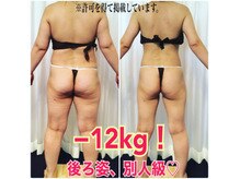 ボディエステティック アクアオーラ 富山店/-12キロ！後ろ姿、別人級！