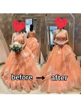 オージャス(OJAS)/【ブライダルエステ】