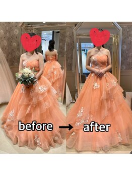 オージャス(OJAS)/【ブライダルエステ】