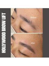 セラス(CERAS)/ハリウッドブロウリフト