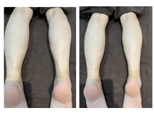 リノ レイ(Lino Ray)/ロミロミ下半身リンパマッサージ