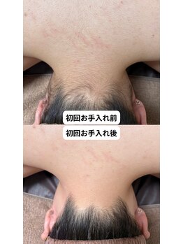 アンジェム(Angem)/初回ビフォーアフター！！！