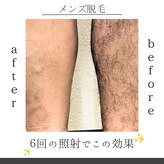 美容&脱毛サロン 金沢文庫