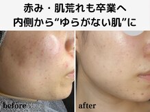 エアル(earu.)