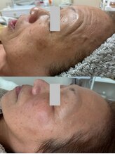 イーサロン(eii salon)/60代女性