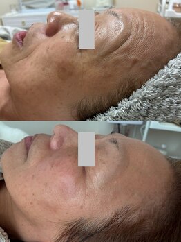 イーサロン(eii salon)/60代女性