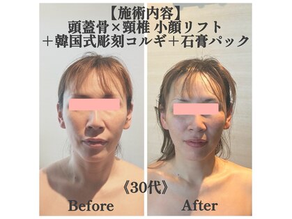 マルウル(maluulu)の写真