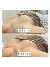 リリーパッソ(Lily passo)/