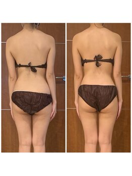 ブランシェ 銀座(blanche)/肩甲骨の左右差も美しく！