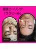 【1回で白玉肌GET】人気ララピール★ララ専用美容液マスク付★肌質改善¥13000
