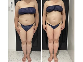 クリア(CLEAR)/リヴァイセルボディ