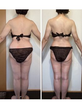 ボンテ(bonte)/痩せてヒップも上がる！