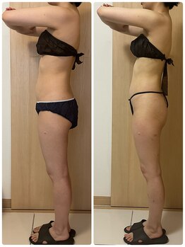 エステサロン エレガンス/