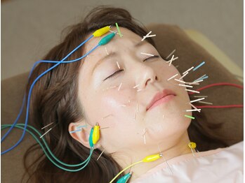 みずのえ鍼灸院